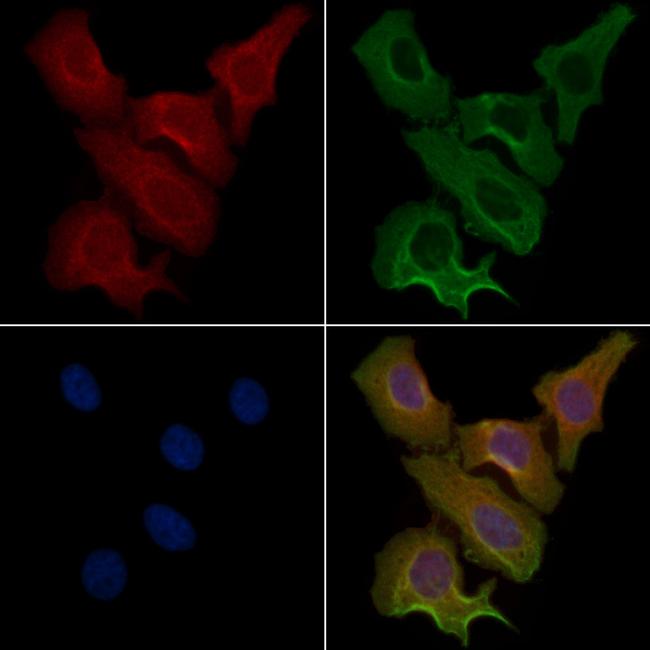 ACOT1 Antibody in Immunocytochemistry (ICC/IF)