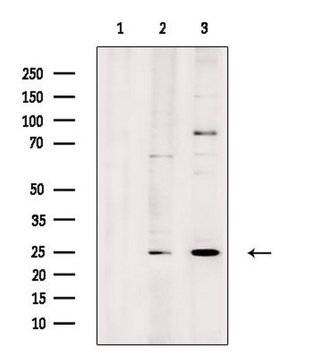 LYPLA1 Antibody in Western Blot (WB)