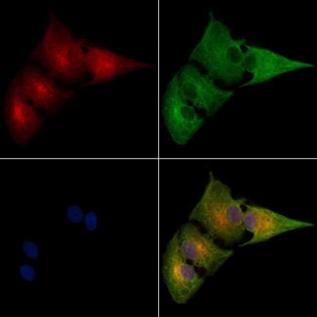 ALDH3B1 Antibody in Immunocytochemistry (ICC/IF)