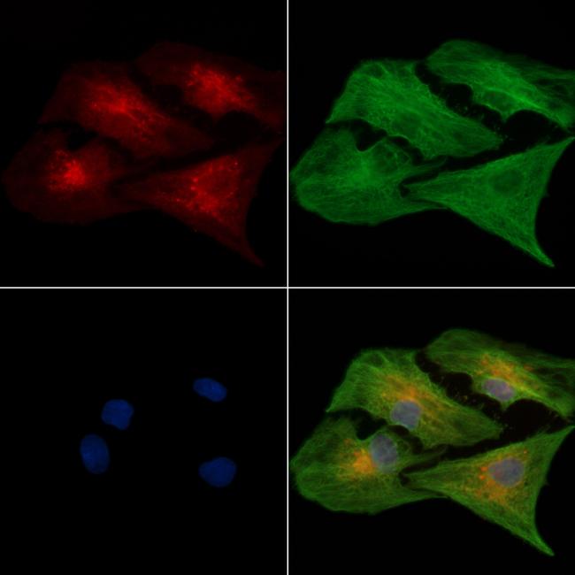 ALDH1B1 Antibody in Immunocytochemistry (ICC/IF)