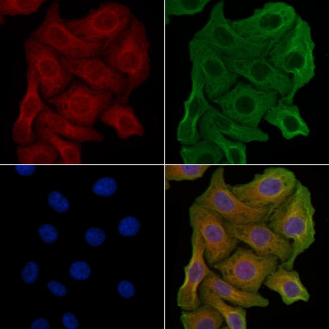 AMPD2 Antibody in Immunocytochemistry (ICC/IF)