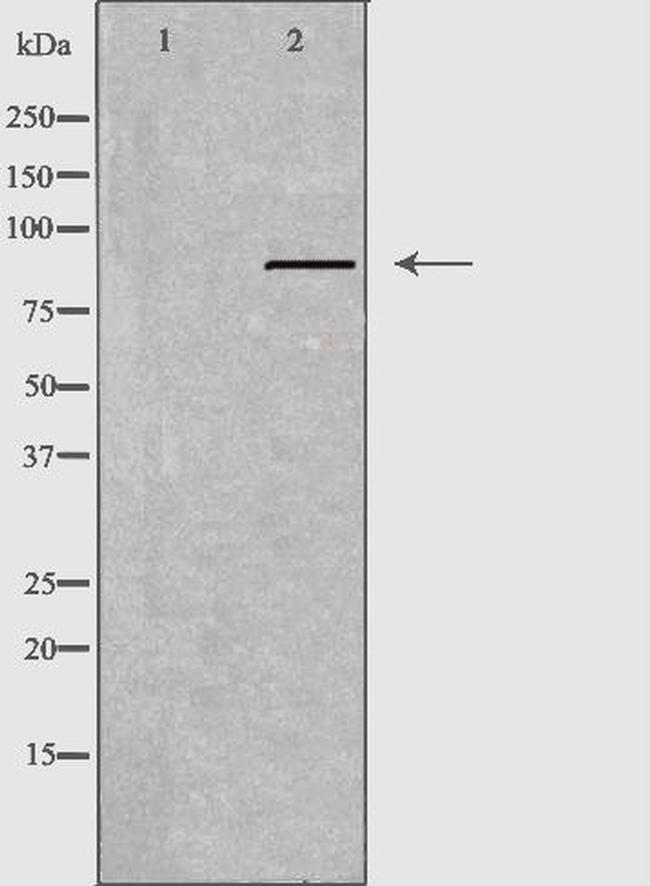 APLP2 Antibody in Western Blot (WB)