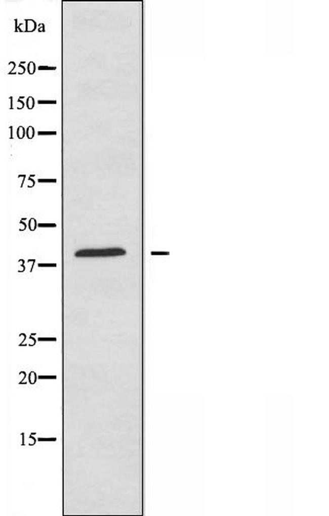 Apolipoprotein A5 Antibody in Western Blot (WB)