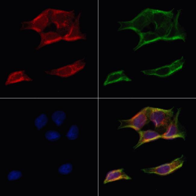 ATP5H Antibody in Immunocytochemistry (ICC/IF)