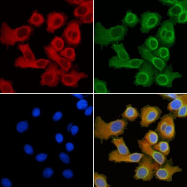 SLC27A5 Antibody in Immunocytochemistry (ICC/IF)