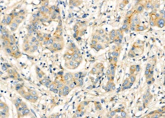 CHP2 Antibody in Immunohistochemistry (Paraffin) (IHC (P))