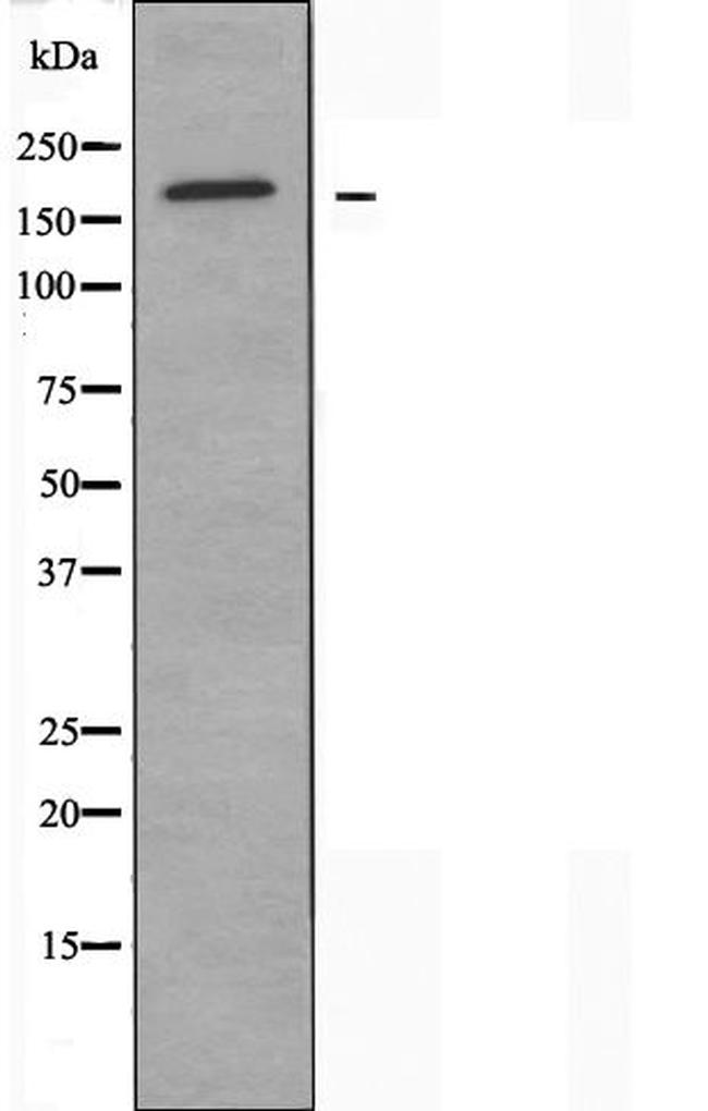 MRP3 Antibody in Western Blot (WB)