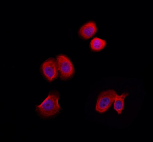 CLIP3 Antibody in Immunocytochemistry (ICC/IF)