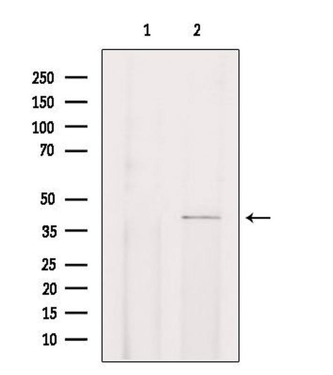 CHST13 Antibody in Western Blot (WB)