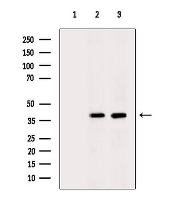 Carboxypeptidase B2 Antibody in Western Blot (WB)