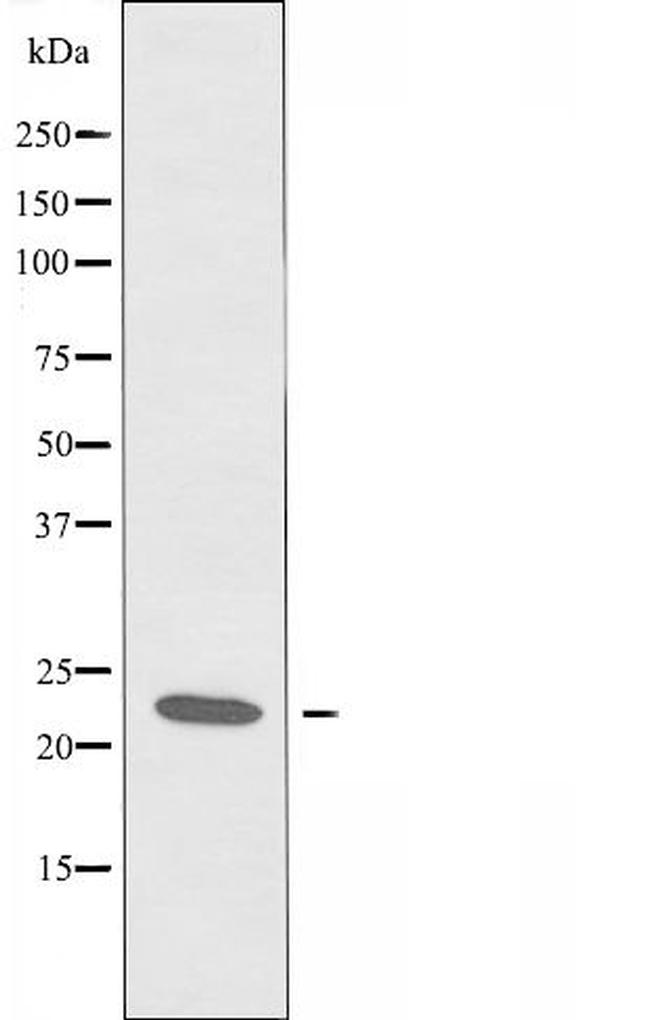 RCL Antibody in Western Blot (WB)