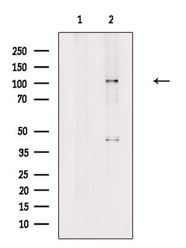 NCAPG Antibody in Western Blot (WB)