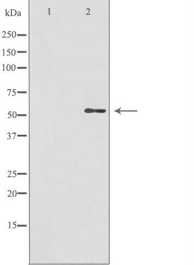 GBA3 Antibody in Western Blot (WB)