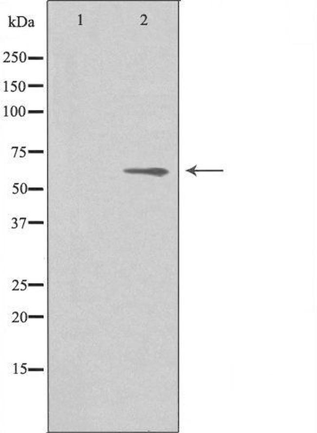 AGBL4 Antibody in Western Blot (WB)