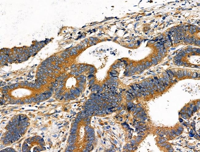 DOCK1 Antibody in Immunohistochemistry (Paraffin) (IHC (P))