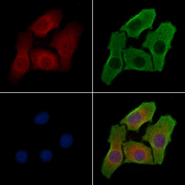 DHPS Antibody in Immunocytochemistry (ICC/IF)