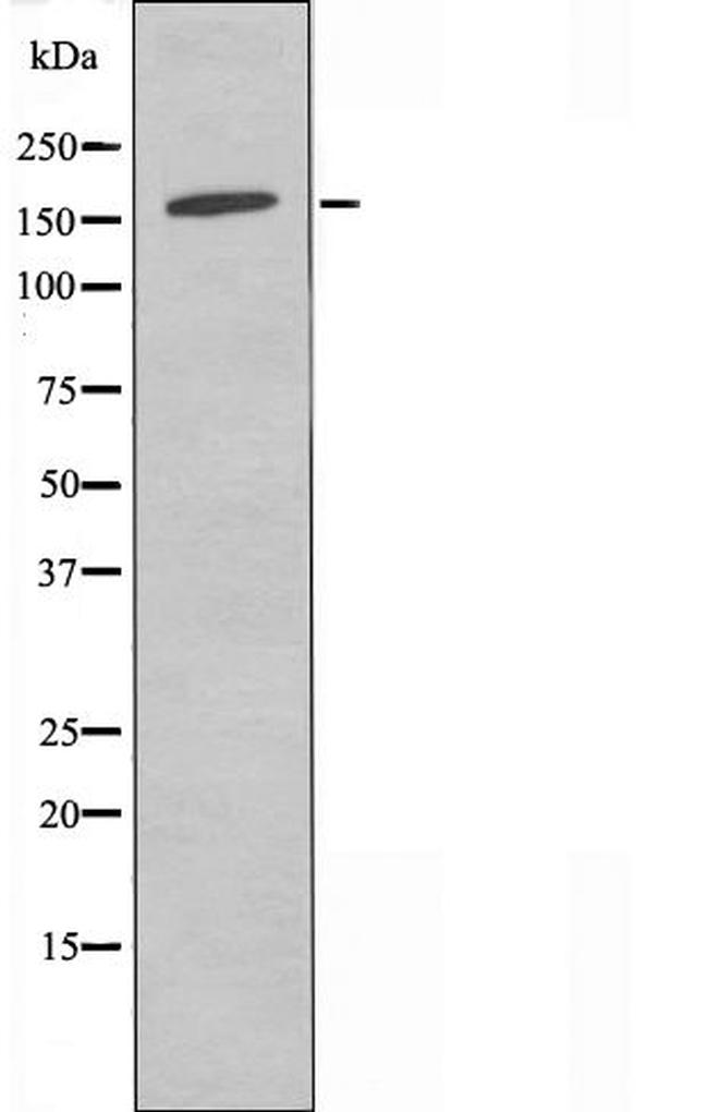 POLR3A Antibody in Western Blot (WB)