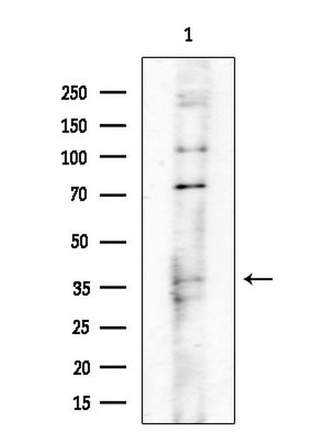 POLR3D Antibody in Western Blot (WB)