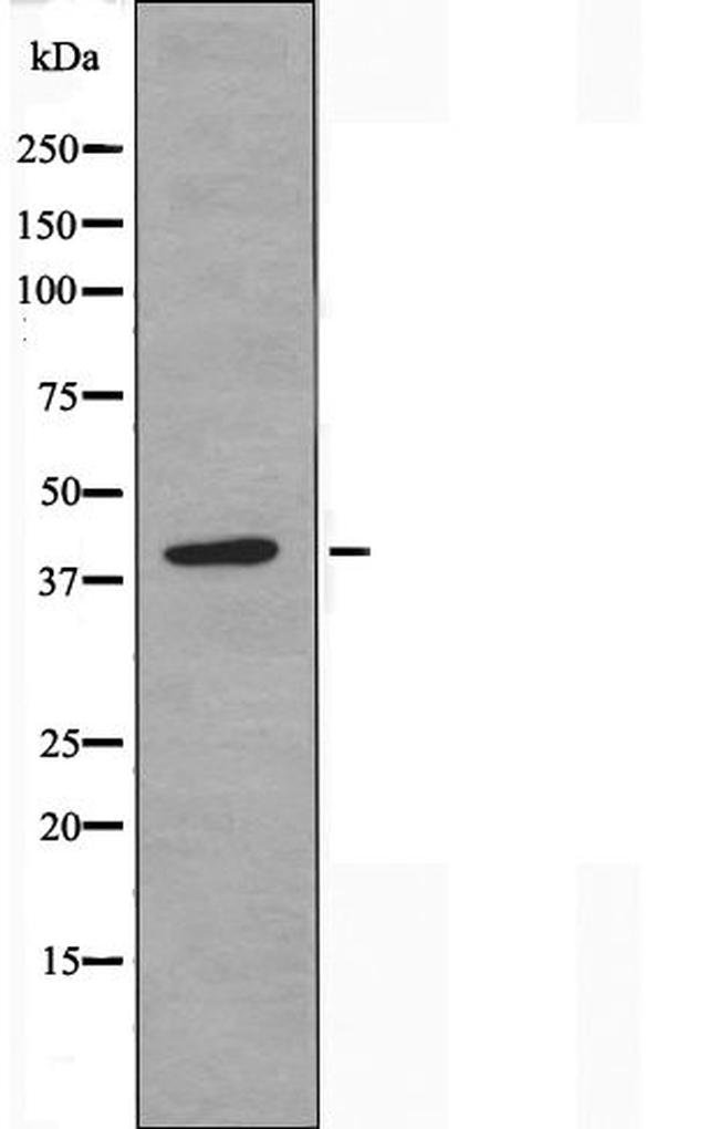 POLR1C Antibody in Western Blot (WB)