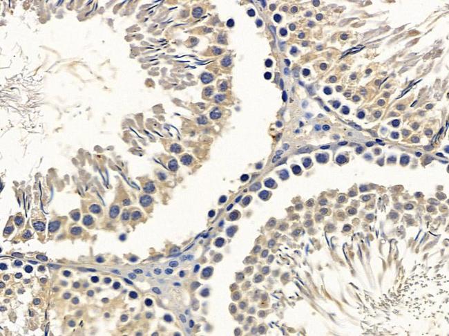 DNAI2 Antibody in Immunohistochemistry (Paraffin) (IHC (P))