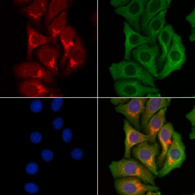 UBR1 Antibody in Immunocytochemistry (ICC/IF)