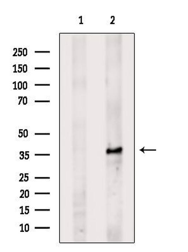 ELOVL4 Antibody in Western Blot (WB)