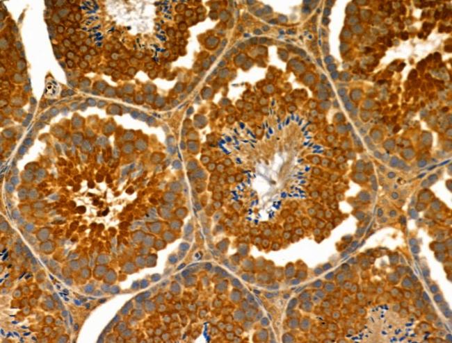 ENDOGL1 Antibody in Immunohistochemistry (Paraffin) (IHC (P))