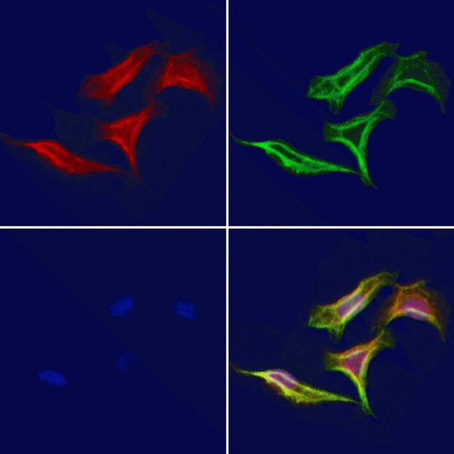 KDELR2 Antibody in Immunocytochemistry (ICC/IF)