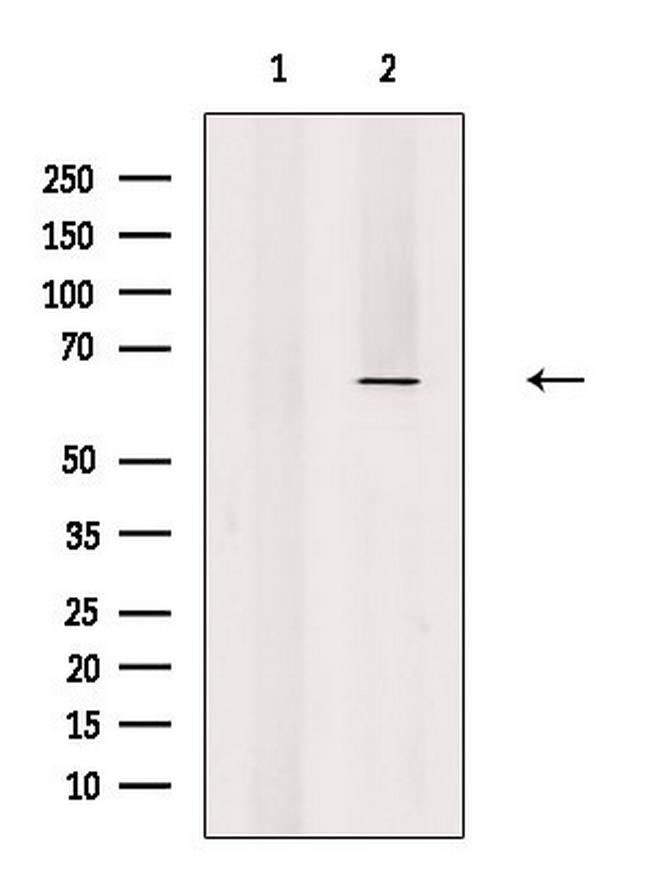 eIF3d Antibody in Western Blot (WB)