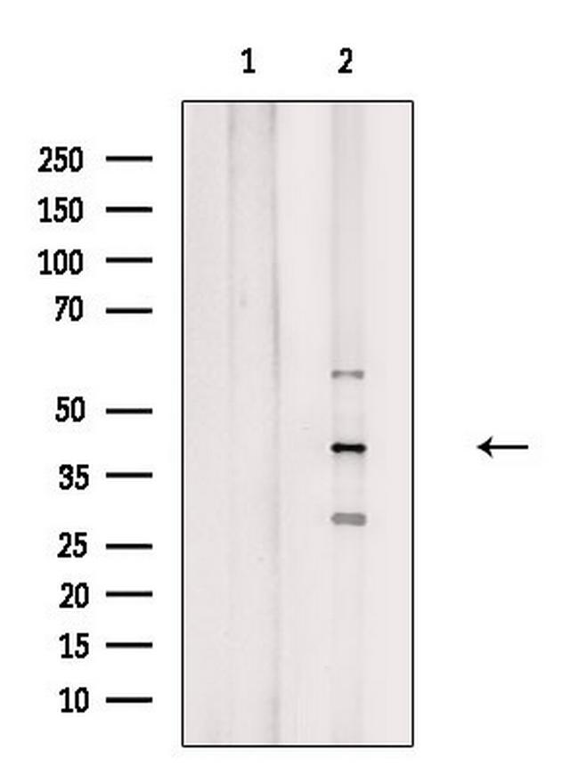 GPS2 Antibody in Western Blot (WB)