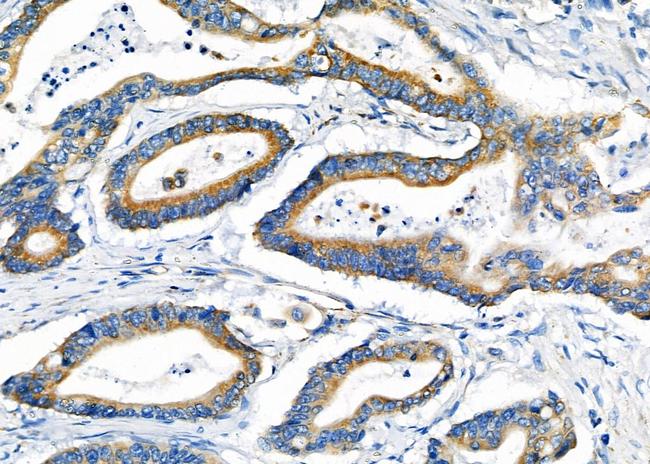 FUT3 Antibody in Immunohistochemistry (Paraffin) (IHC (P))