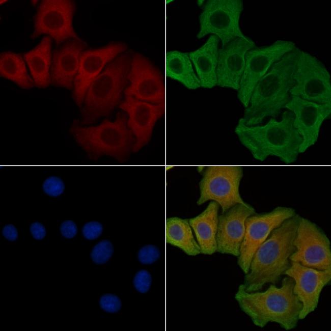 NMDAR2D Antibody in Immunocytochemistry (ICC/IF)