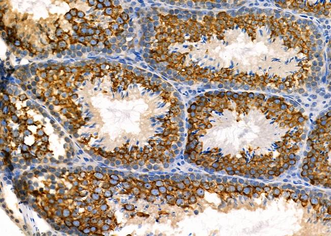 GAS1 Antibody in Immunohistochemistry (Paraffin) (IHC (P))