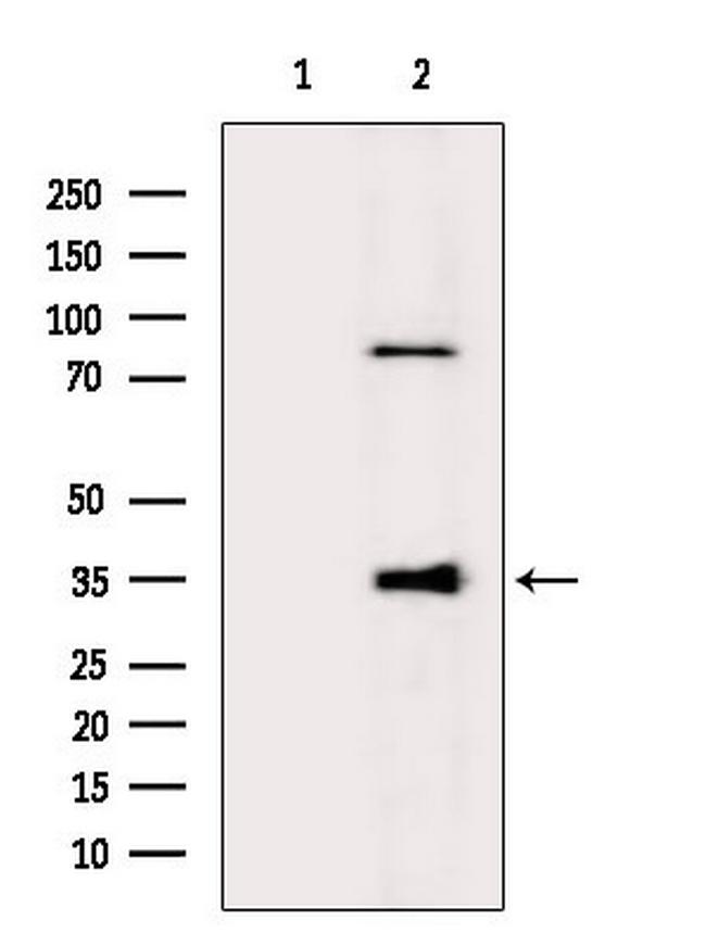 GIMAP5 Antibody in Western Blot (WB)