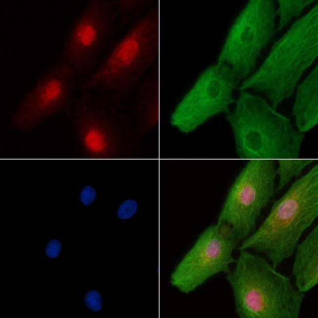 SIX1 Antibody in Immunocytochemistry (ICC/IF)