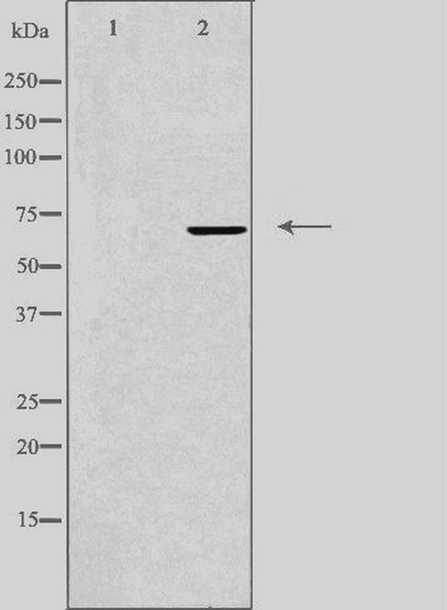 IQCB1 Antibody in Western Blot (WB)