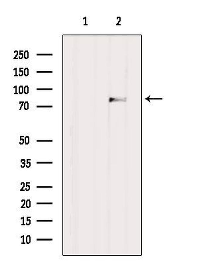 MASP2 Antibody in Western Blot (WB)