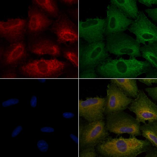 NOX5 Antibody in Immunocytochemistry (ICC/IF)