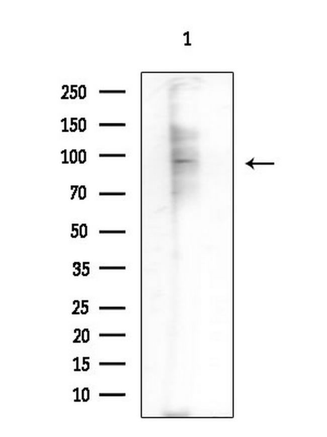 N4BP1 Antibody in Western Blot (WB)