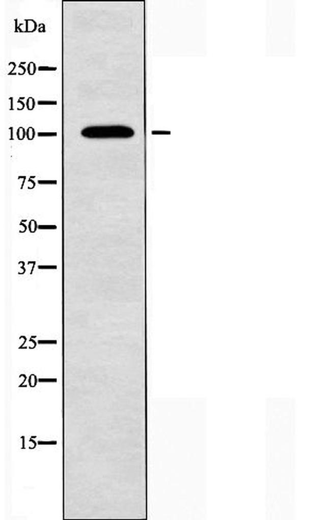 NCAM2 Antibody in Western Blot (WB)