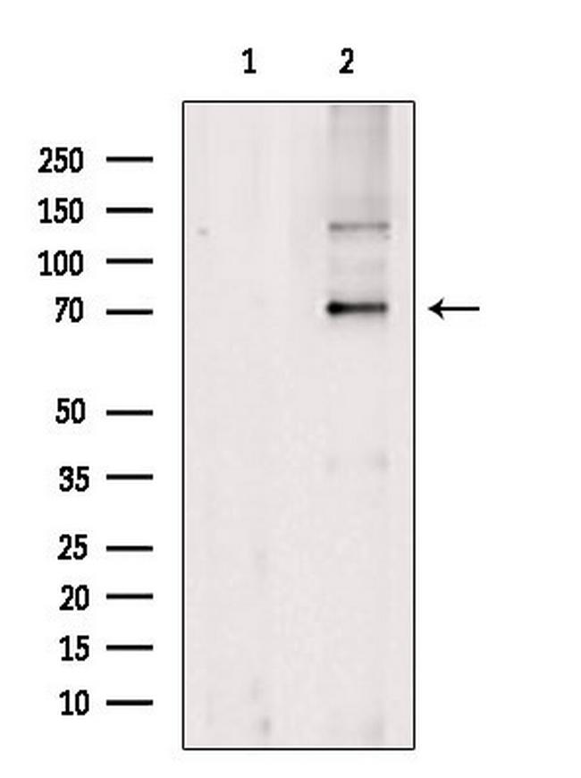 NXF3 Antibody in Western Blot (WB)