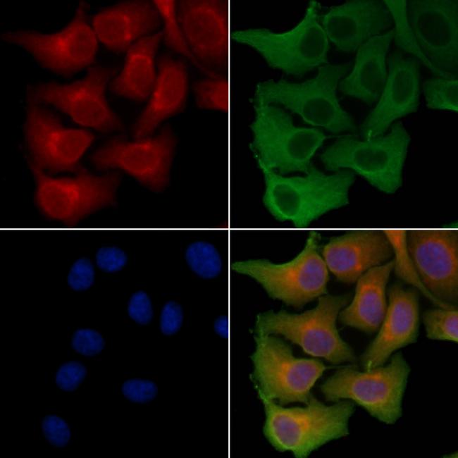 SLC6A15 Antibody in Immunocytochemistry (ICC/IF)