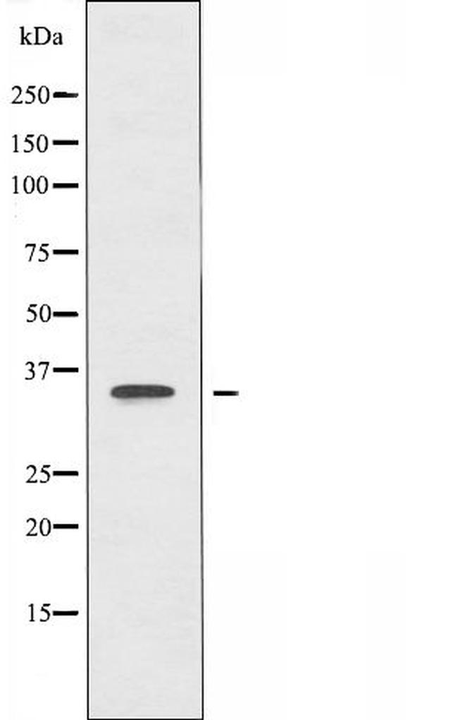 DECR2 Antibody in Western Blot (WB)