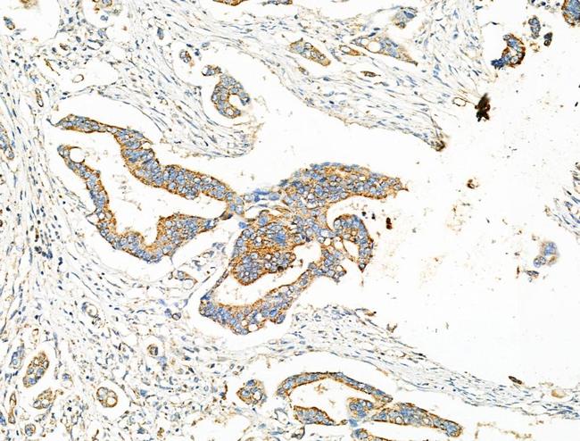 EHHADH Antibody in Immunohistochemistry (Paraffin) (IHC (P))