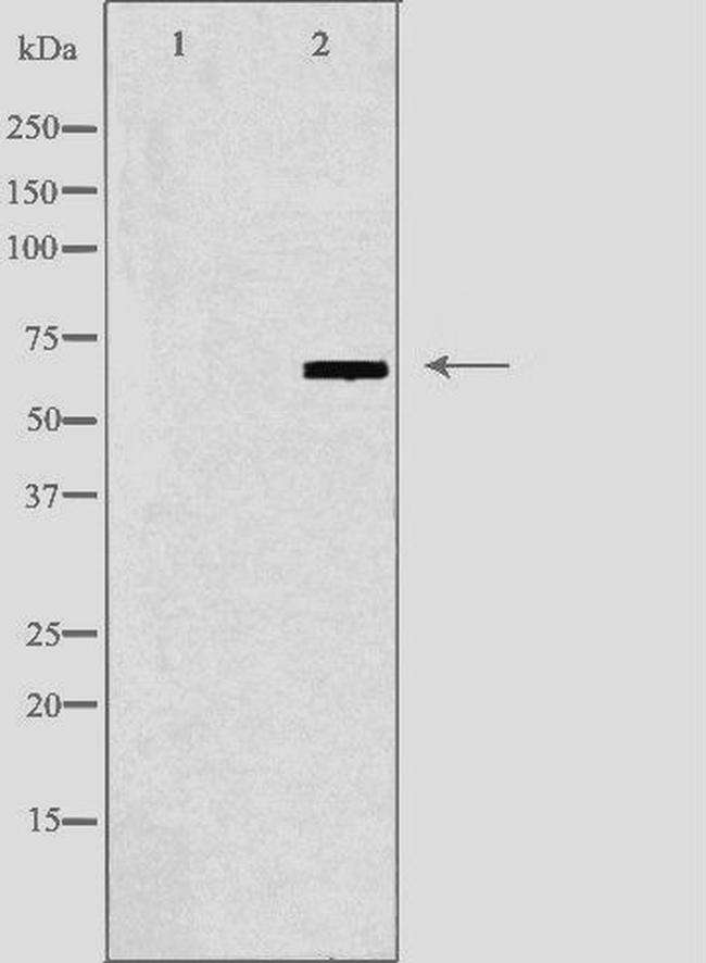 N4BP2L2 Antibody in Western Blot (WB)