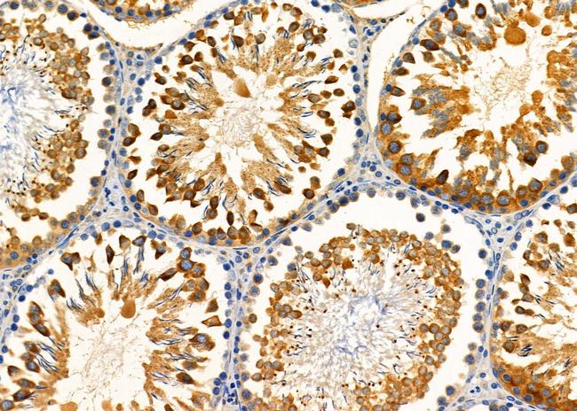 KCNK12 Antibody in Immunohistochemistry (Paraffin) (IHC (P))