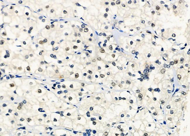 SF3B14 Antibody in Immunohistochemistry (Paraffin) (IHC (P))