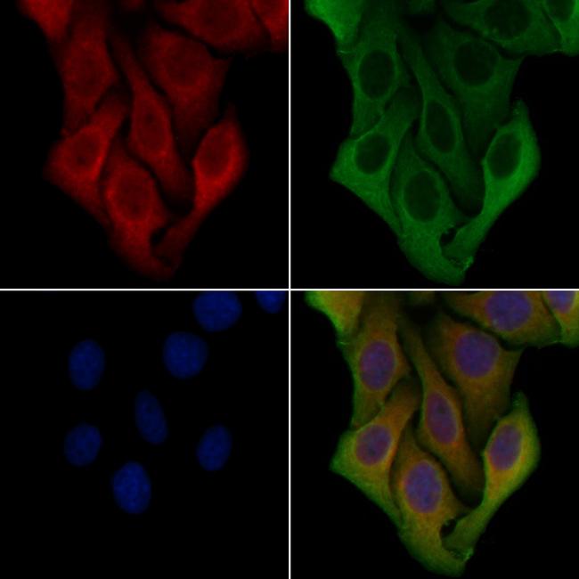 PPP1R3C Antibody in Immunocytochemistry (ICC/IF)