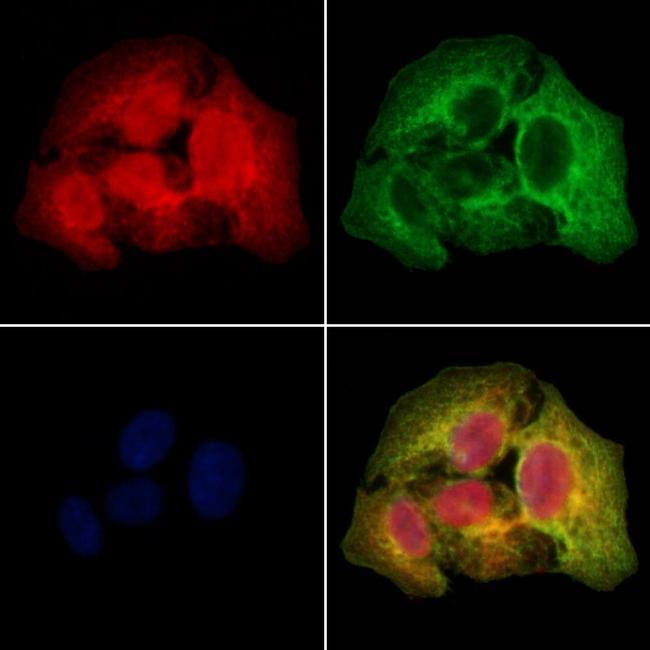 SSH3 Antibody in Immunocytochemistry (ICC/IF)