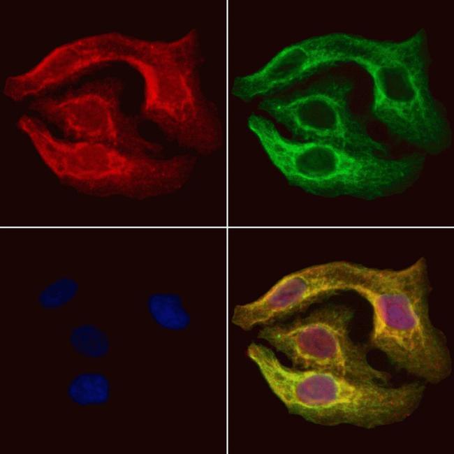 Pyruvate Carboxylase Antibody in Immunocytochemistry (ICC/IF)